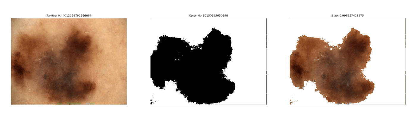 Three panels: the resized lesion, its computed mask, and the recoloured lesion, labelled Radius 0.44, Color 0.48, Size 0.996
